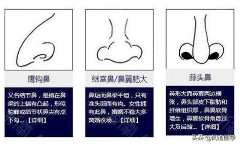 鼻面相男|鼻相分析10款｜鼻樑有節及橫紋、豬膽鼻、鼻頭下垂代表甚麼？姻 